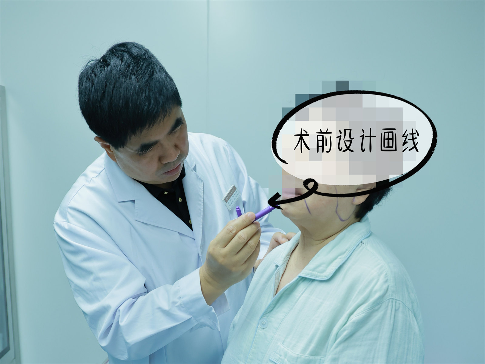 60岁姐姐挑战拉皮手术，术后3个月变得大不一样