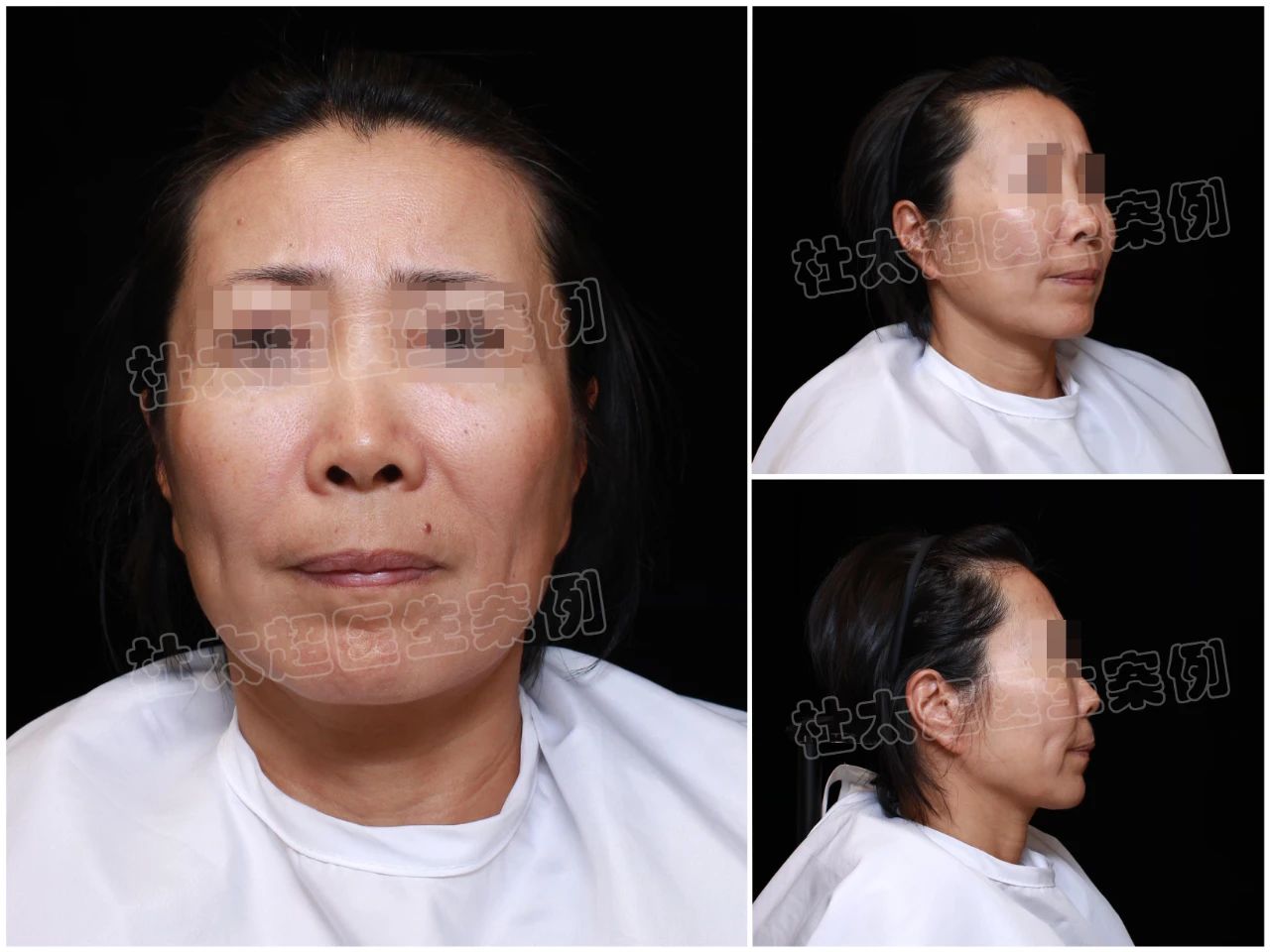 我的医美重生之路：与杜太超教授的相遇