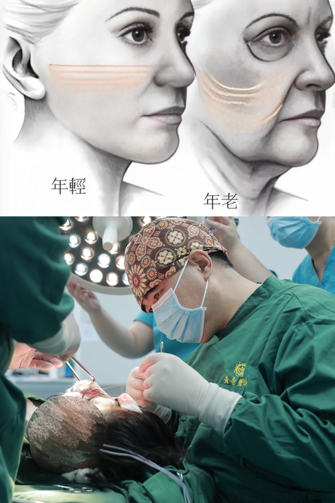 岁月不饶人，45岁的你如何应对？拉皮手术抗衰老的最后防线？