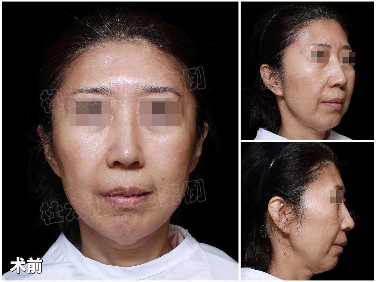 《刀尖上的青春：一场关于美的勇敢冒险》