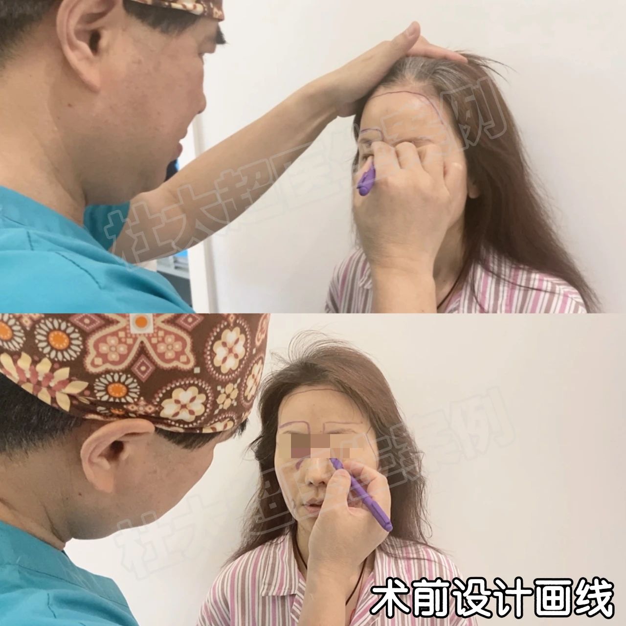 朋友圈重现颜值担当，3小时拉皮手术后100%自信回归！