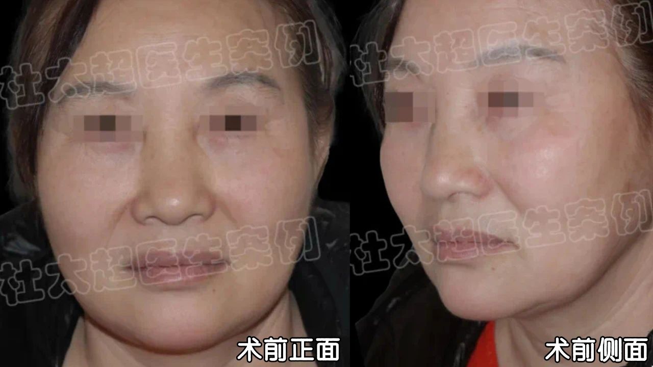 从“吓人”的脸到惊艳的状态！53岁的她4个月只干了这一件事！