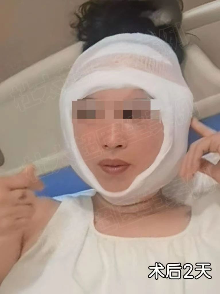 【曝光】我被5000元拉皮手术给毁了！是他拉我走出深渊！
