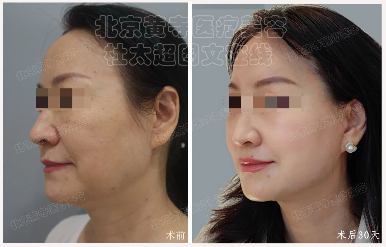 “整容失败”？不，你只是没看到我背后的故事