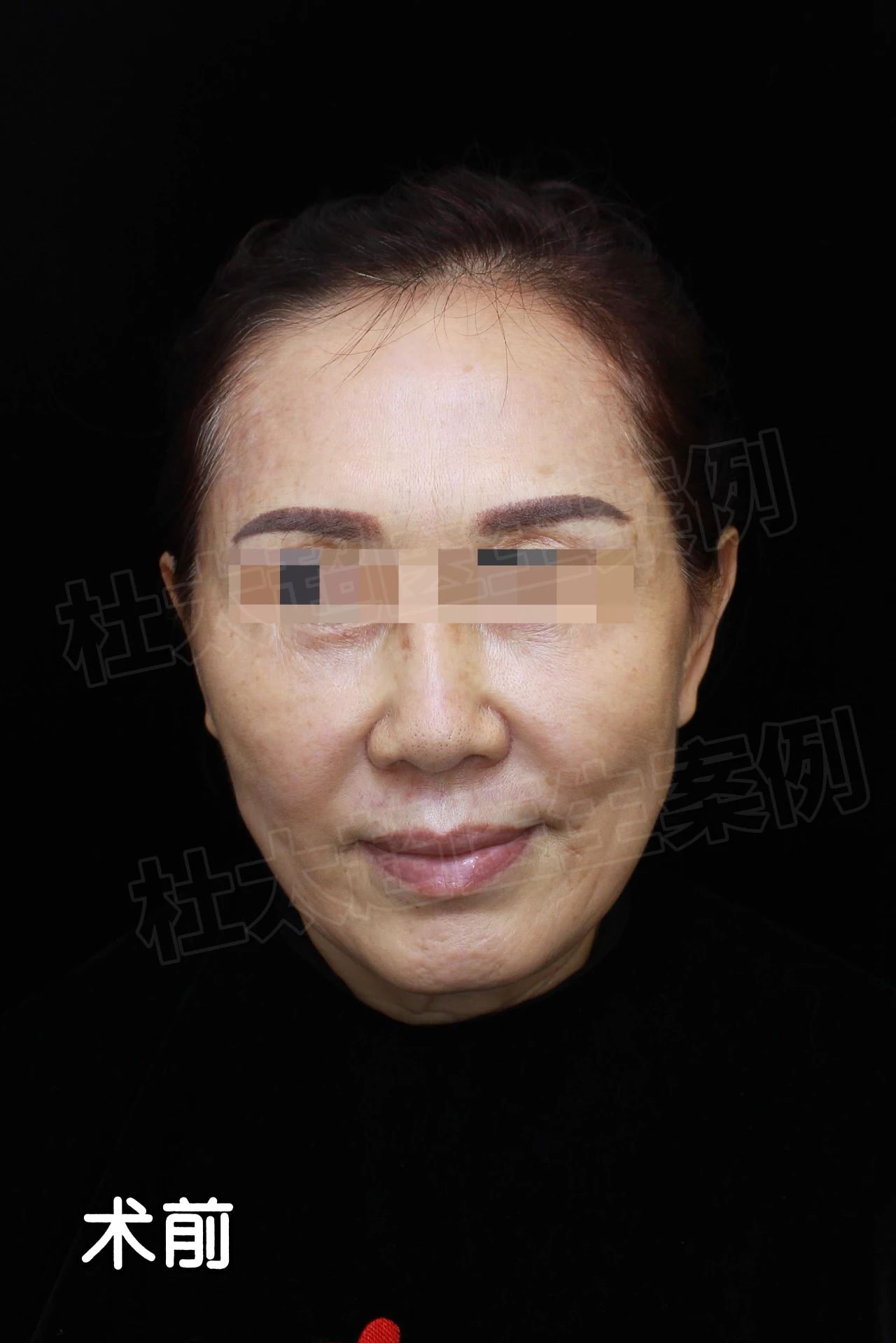 【迷局】杜太超教授的手术刀下，是真相还是谎言？密谈揭开真相一角！