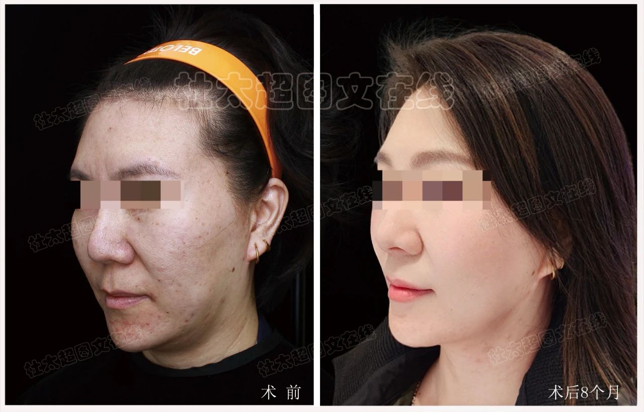 在众多医生同行中，我偏偏要选择了杜教授做这场手术！