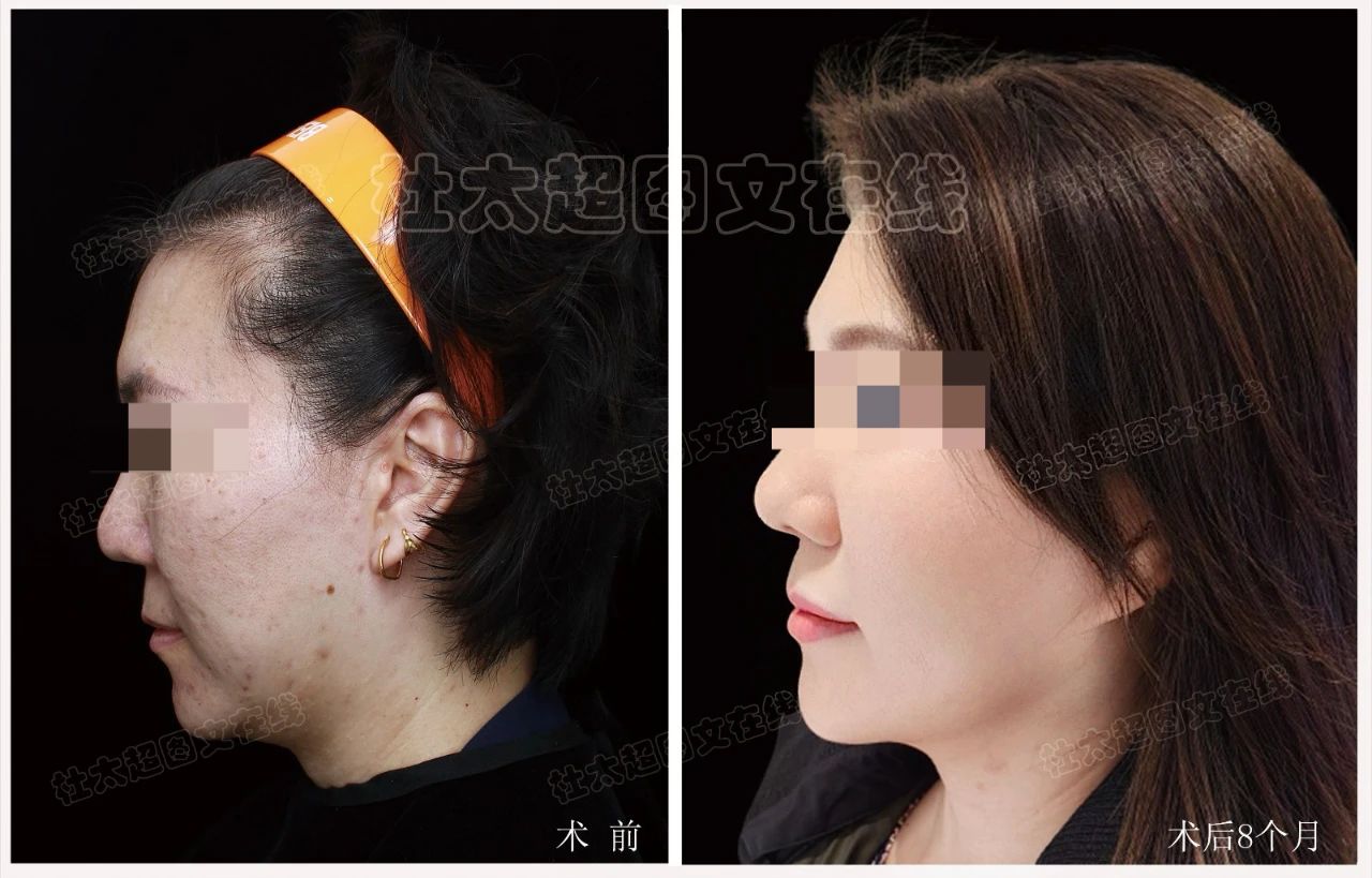 在众多医生同行中，我偏偏要选择了杜教授做这场手术！