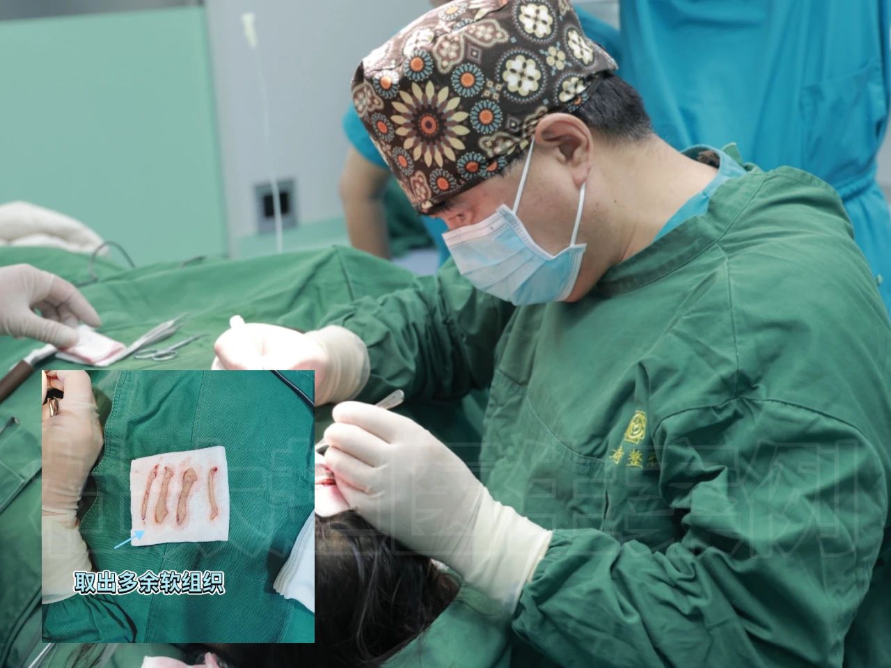 48岁在北京做拉皮手术到底花了多少钱？!7天从“黄脸婆”到“大飒蜜”的她，直言中年人就该薄情一点！