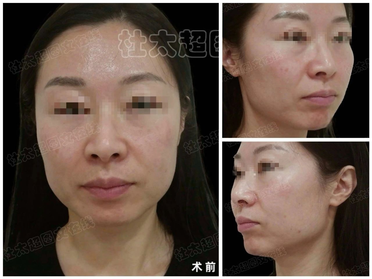 1736776315165616.jpg 微信图片_20250113215048.jpg