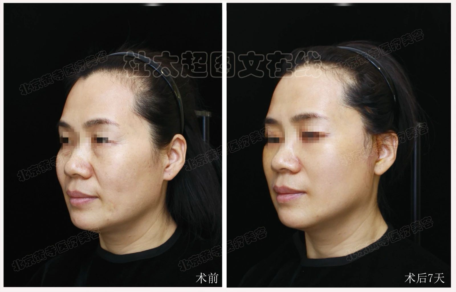 1739423433134113.jpg 微信图片_20250213130747.jpg