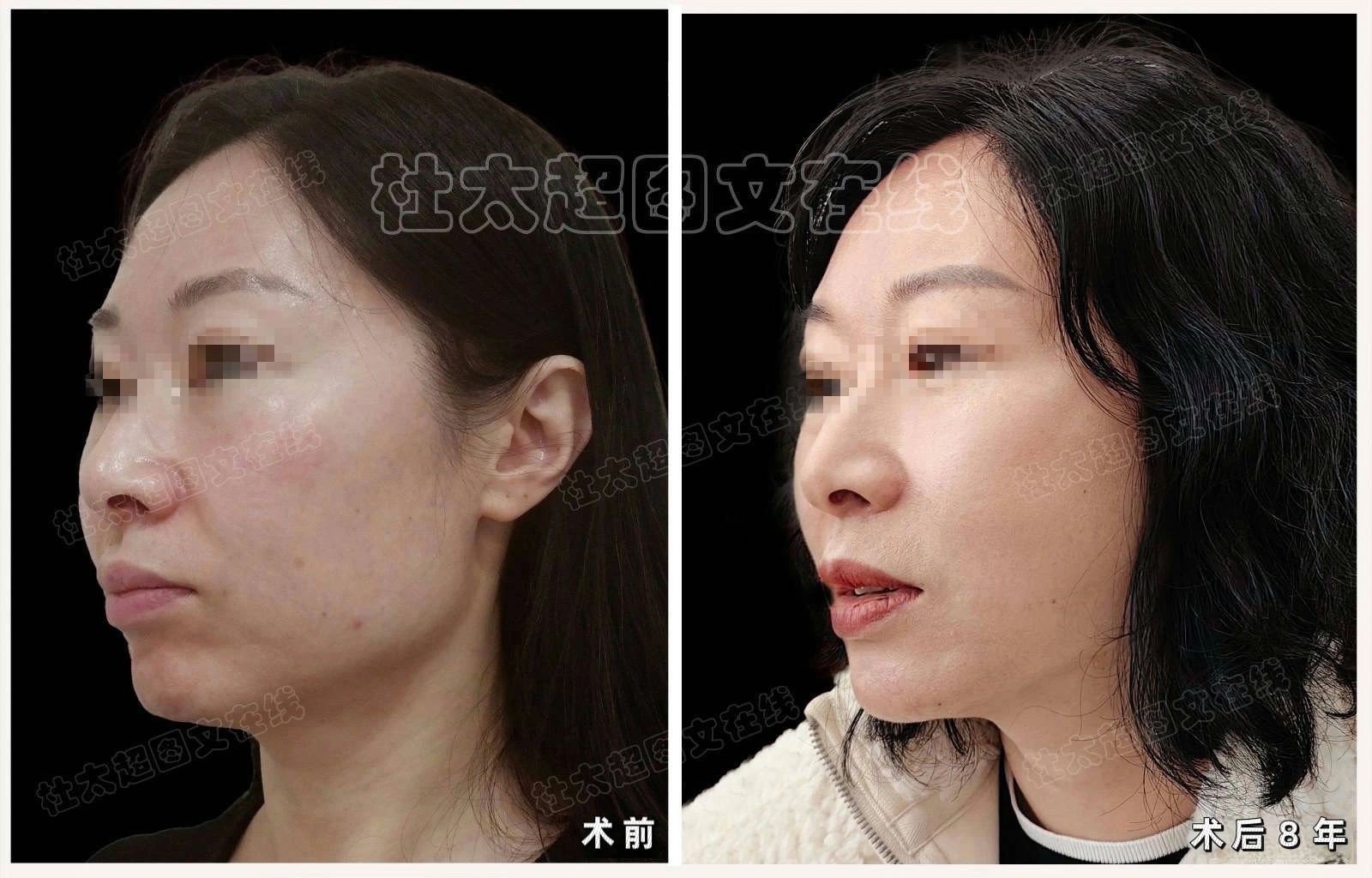 1739665752113835.jpg 微信图片_20250216081352.jpg