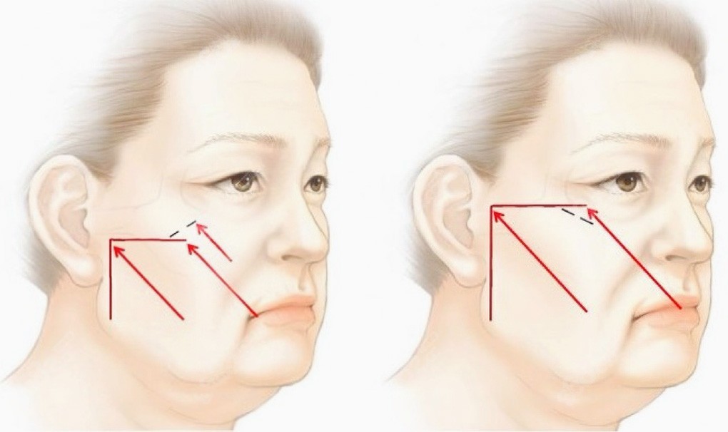 1740011774491489.jpg 222.jpg